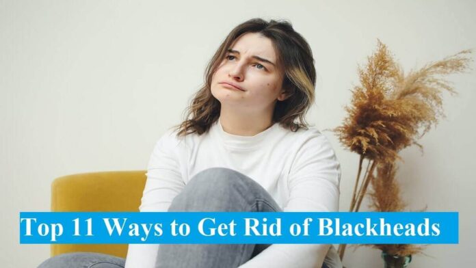 easy ways to get rid of blackheads | blackhead removal