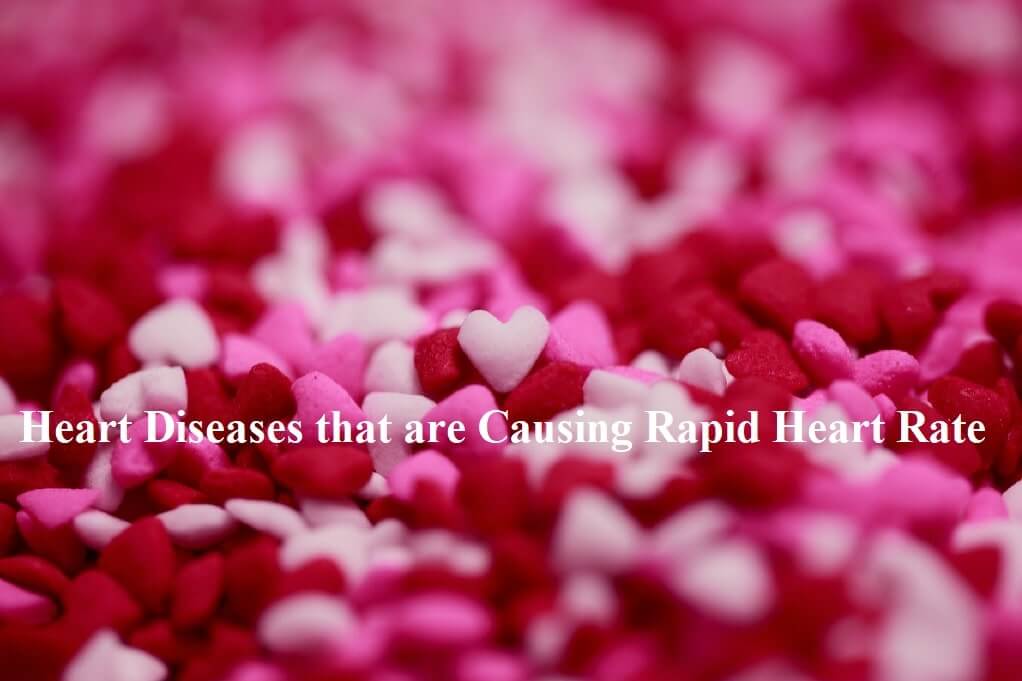 Heart Diseases that are Causing Rapid Heart Rate