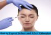 What to Expect Before and After Rhinoplasty Rhinoplasty