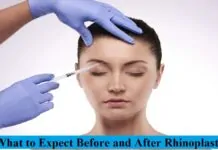 What to Expect Before and After Rhinoplasty Rhinoplasty