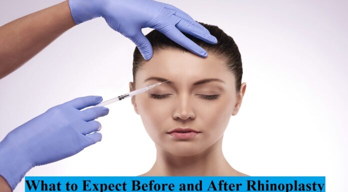 What to Expect Before and After Rhinoplasty Rhinoplasty